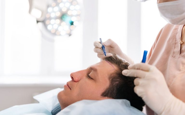 How to Choose a Hair Transplant Clinic in Turkey?