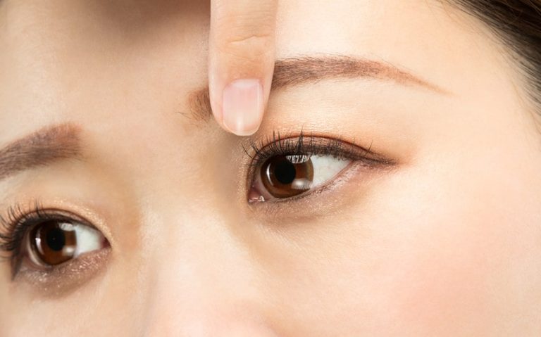 Is It Time to Consider Surgery for Your Double Eyelids?